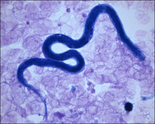 Mansonella_perstans.htm _ bfdecont